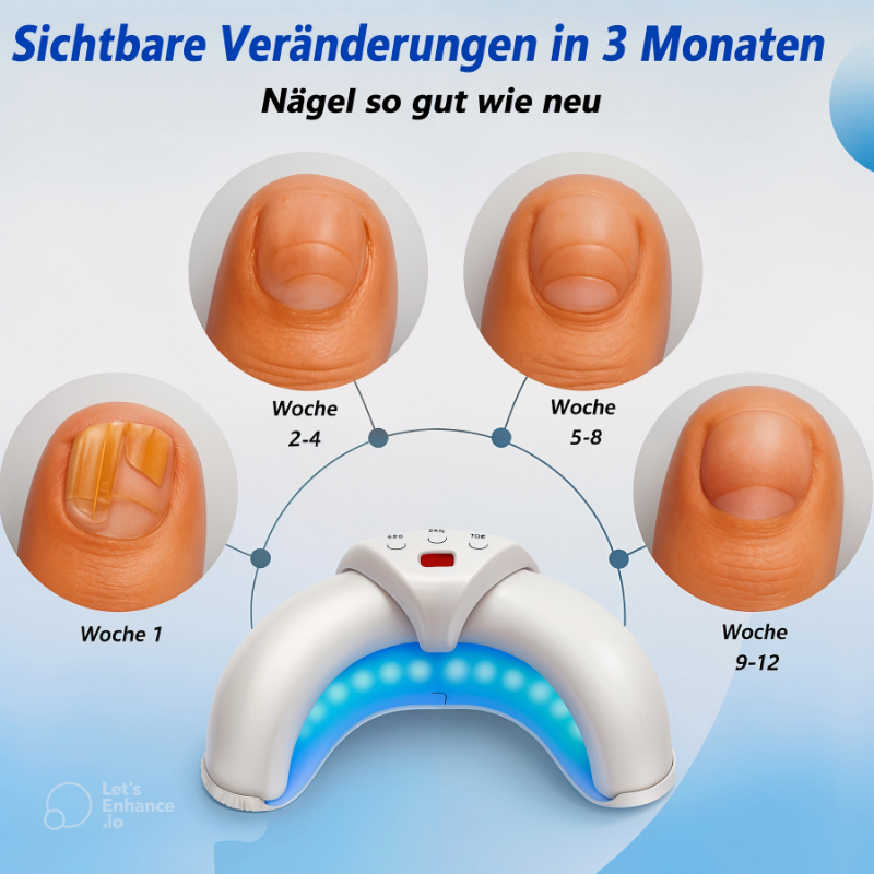 ClearNail Pro – Der Laser gegen Nagelpilz