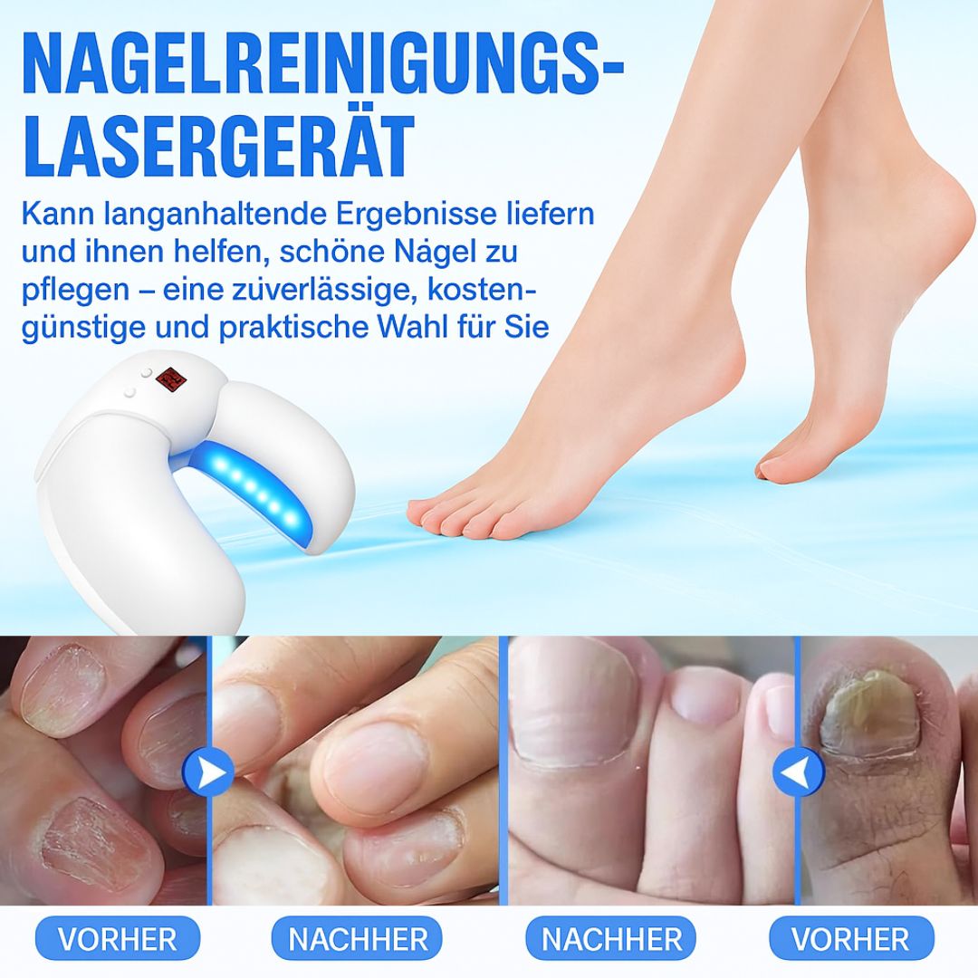 ClearNail Pro – Der Laser gegen Nagelpilz