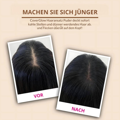 Hairline Roots Powder